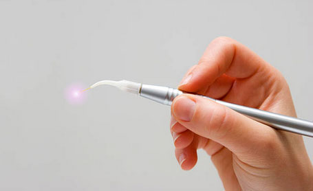 dental-laser