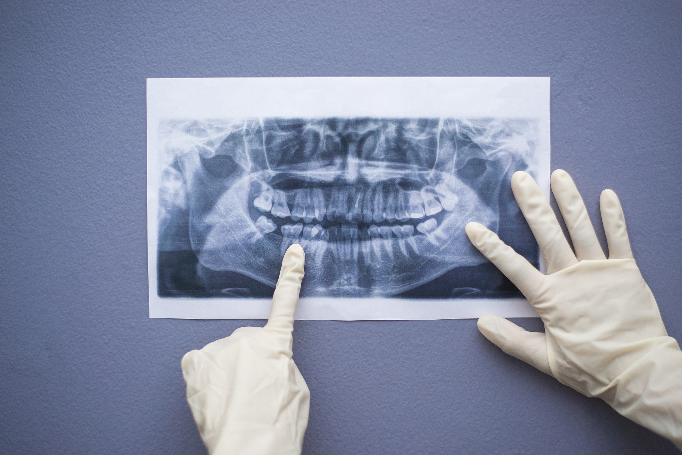 Female dentist holding a dental X-Ray