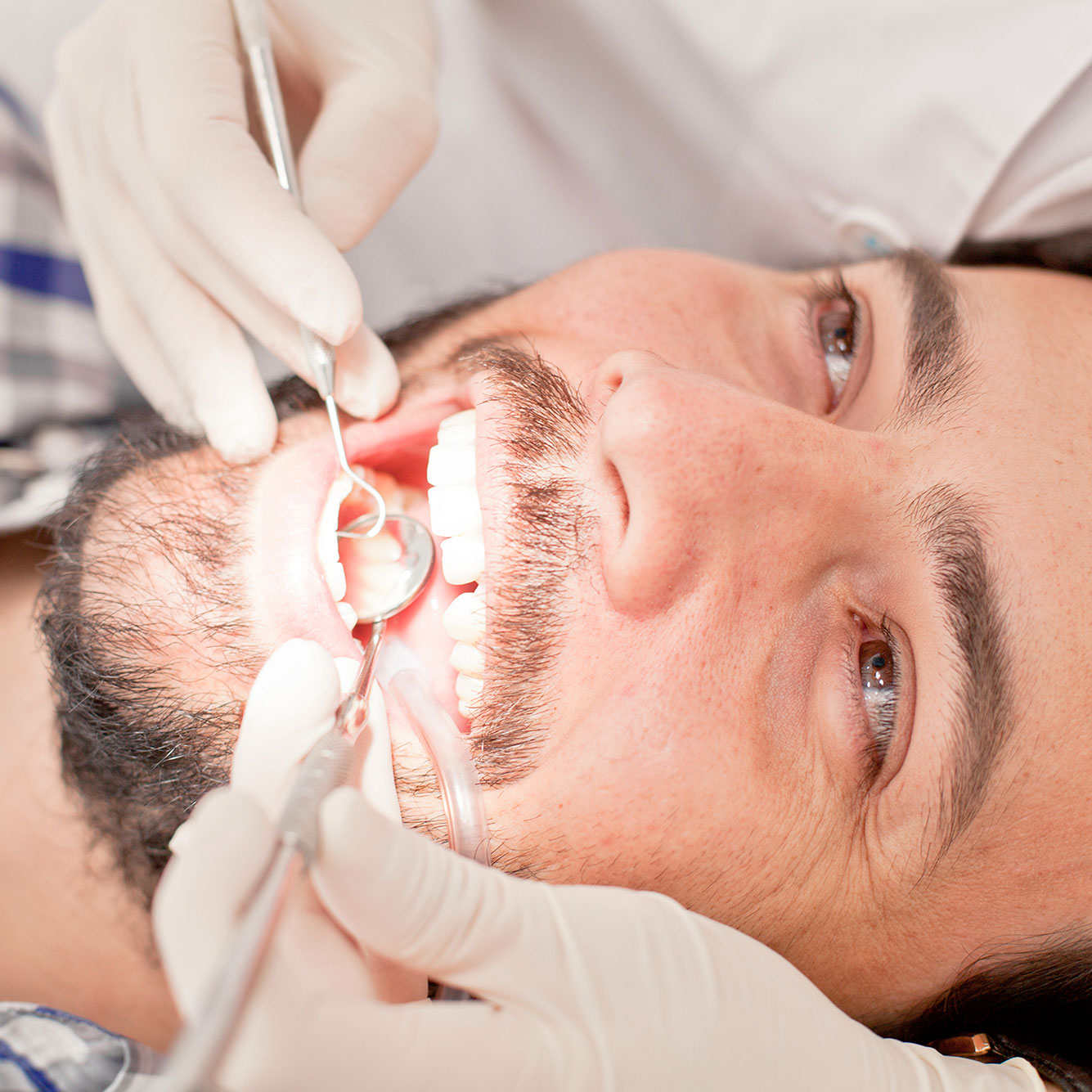 καθαρισμός, dental cleaning